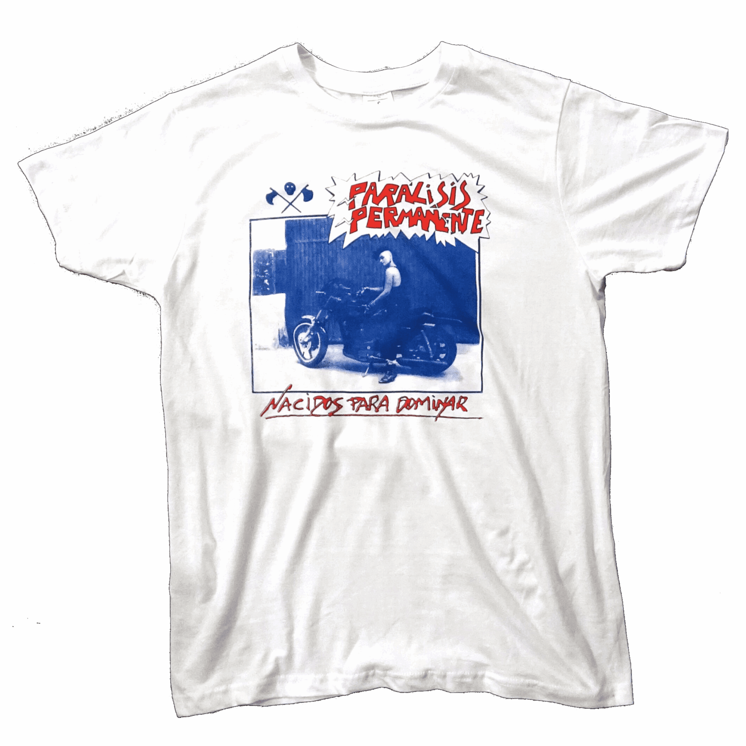 PARÁLISIS PERMANENTE